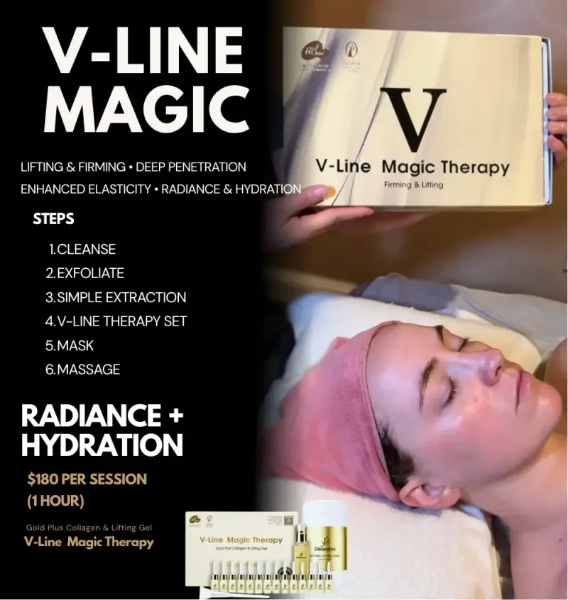 V-Line Magic