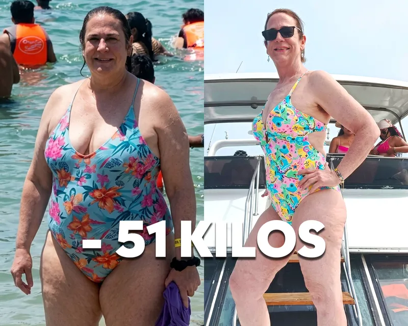 Antes y después: -51 kilos