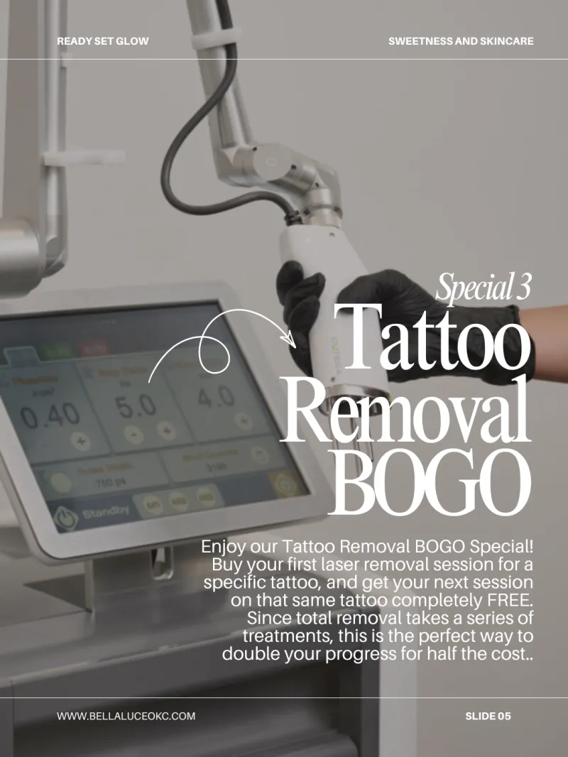 BOGO Tattoo Removal (XS)