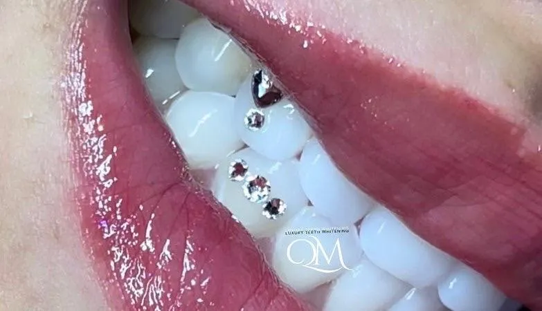 In-Person Tooth Gem Training