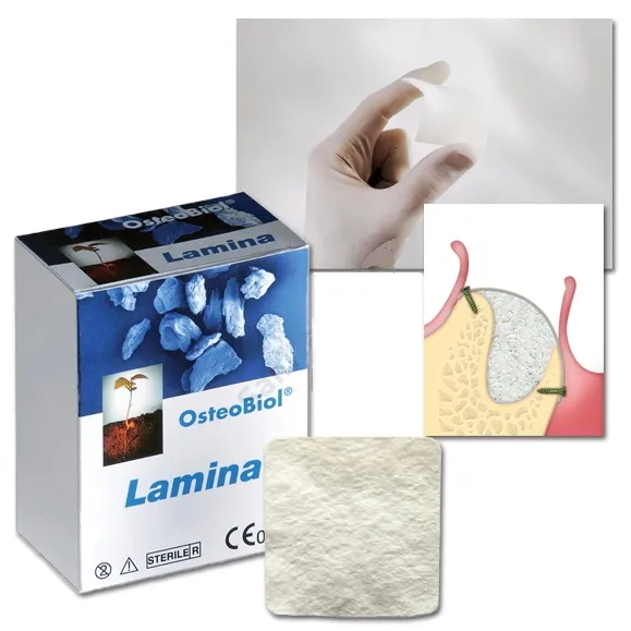 [A00142882] - osteobiol lamina corticale sf essiccata 25x25mmtecnoss