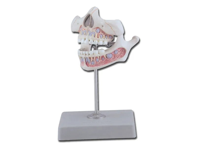 [A00014134] - Dentatura giovanile