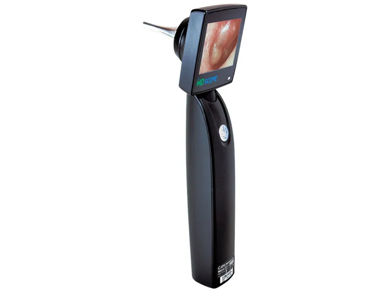 [A00060505] - videotoscopio md scope - completo di 2 sonde