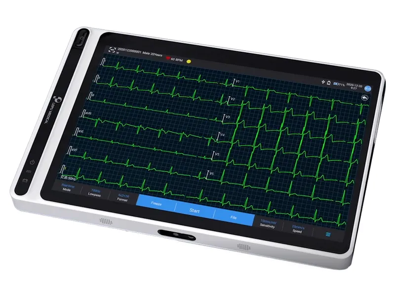 [A00168501] - p16 neo ecg s120 - tablet ecg Gima