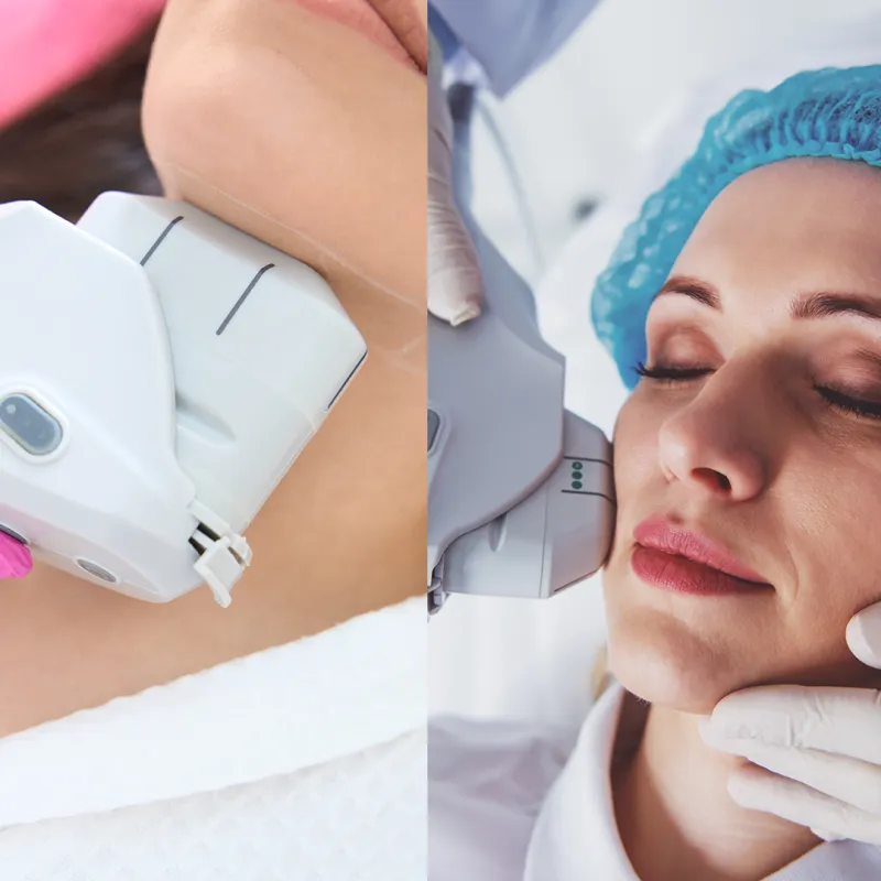 HIFU Facial + Neck