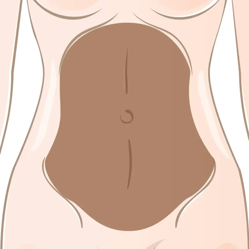 Abdomen