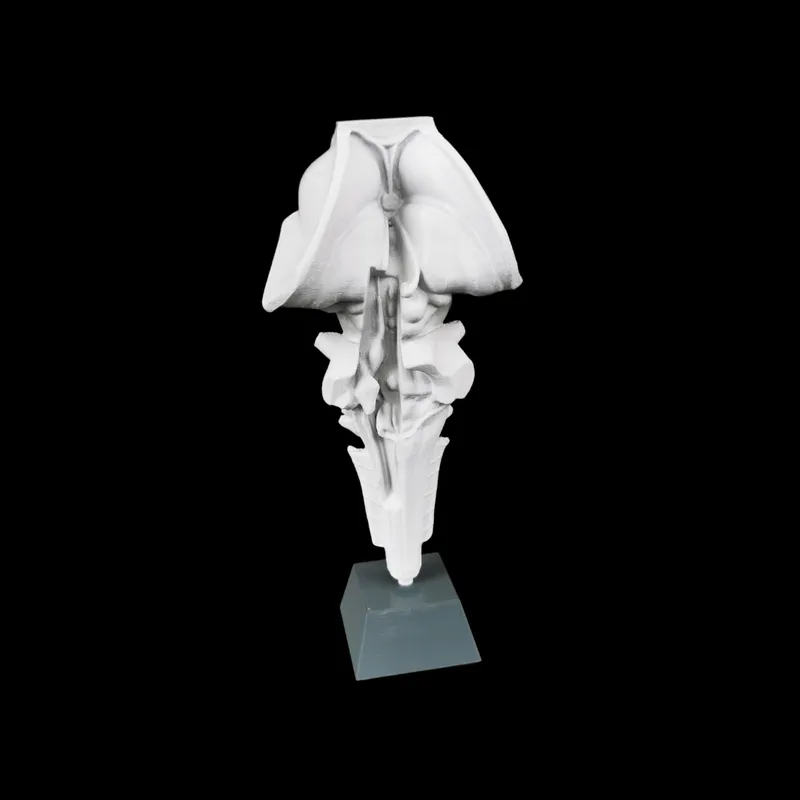 Brainstem with Cranial Nerves