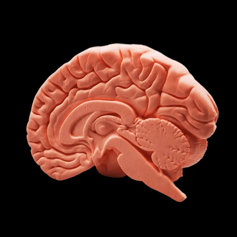 Human Brain – Sagittal Section