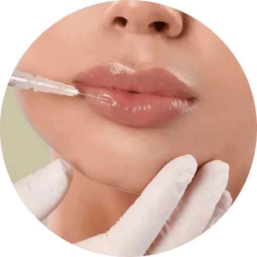Filler Packages