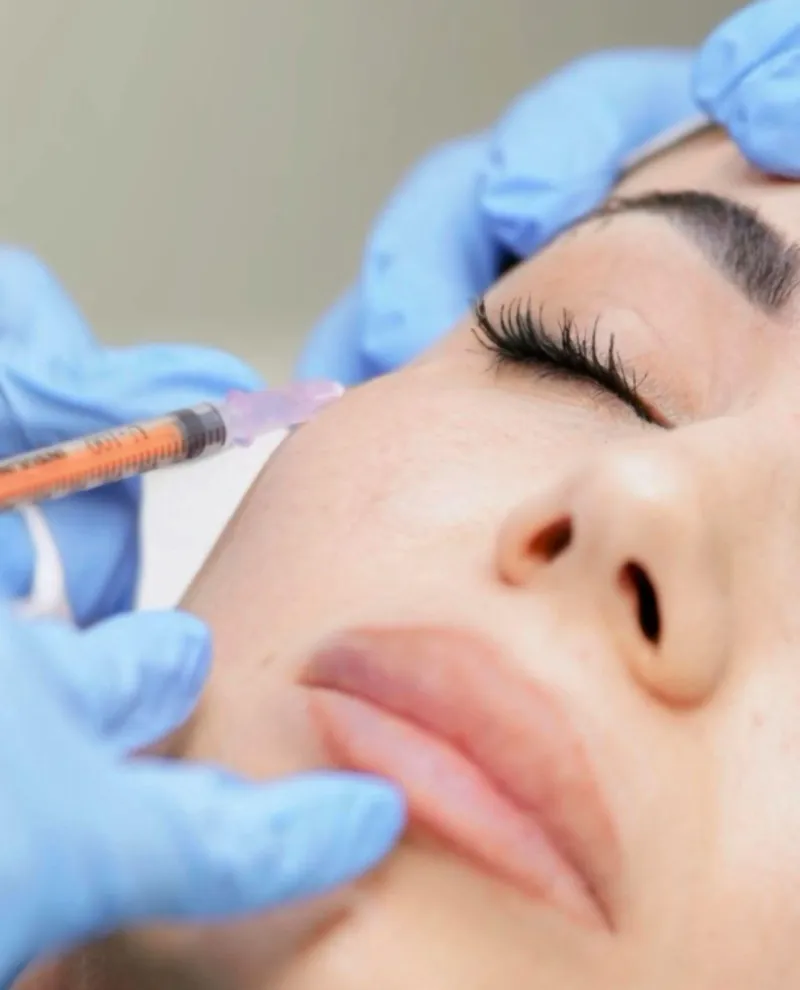 Botox Classico – Trattamento Rughe Viso