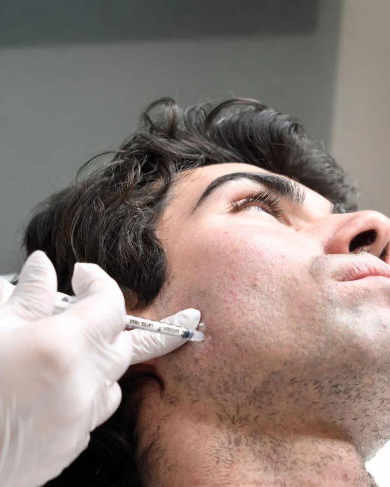 Botox al massetere