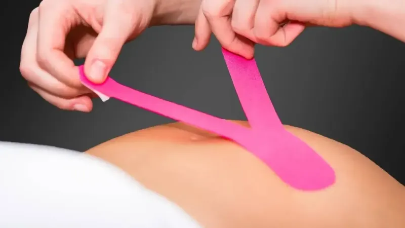 Perfect Hebamme - Indikation im kinesiologischen Tapen