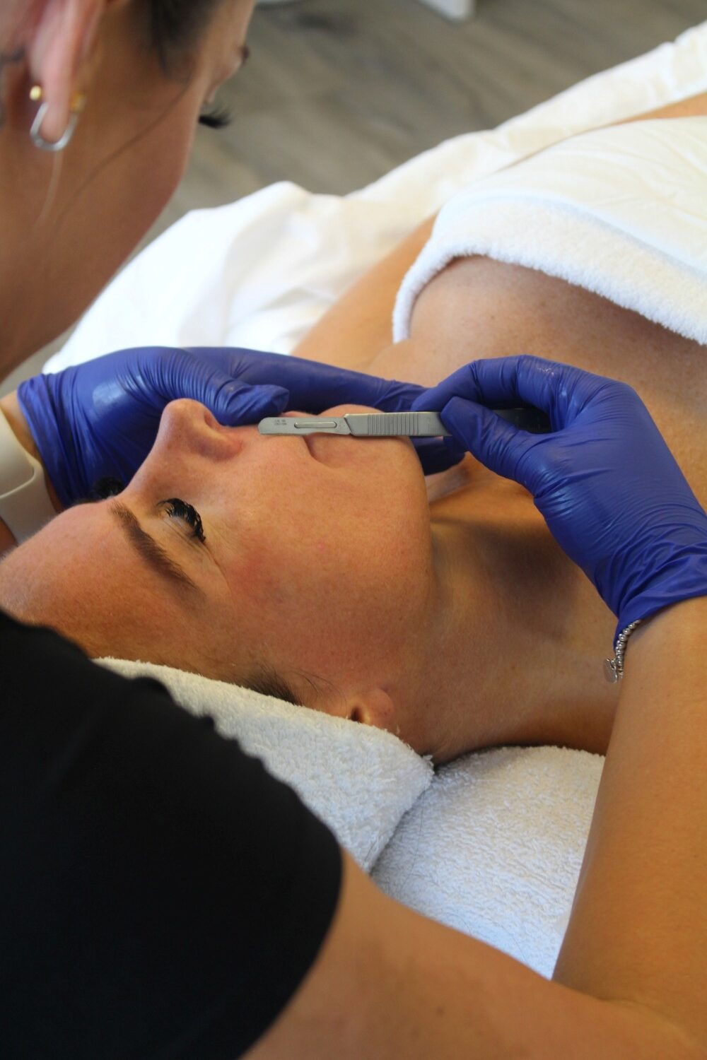 Dermaplaning Facial