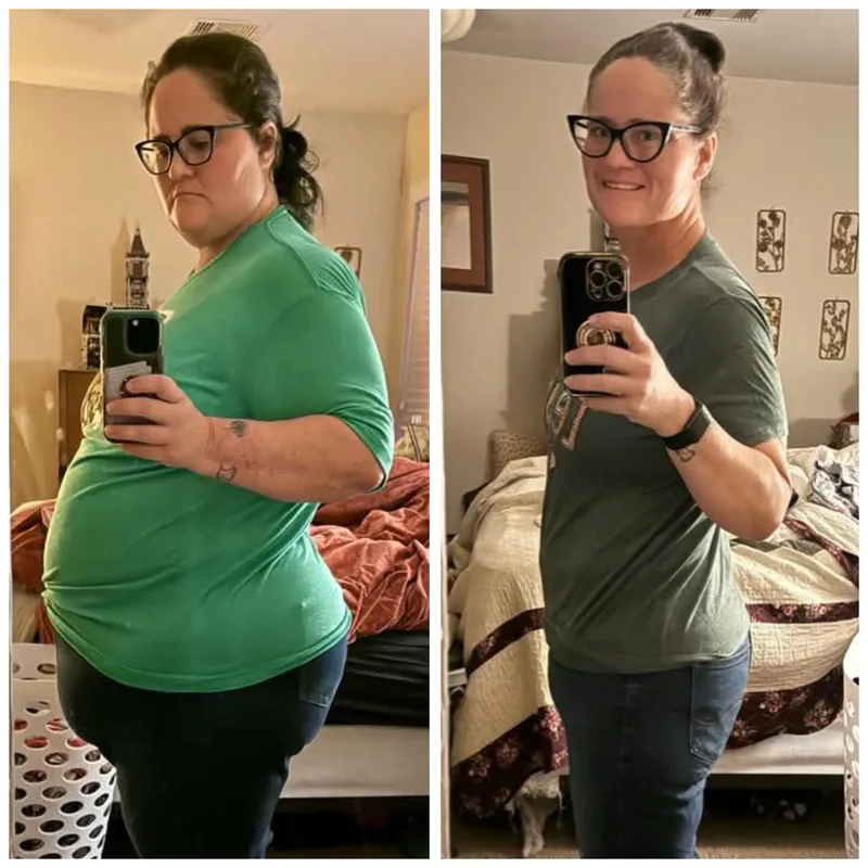 Amanda before and after