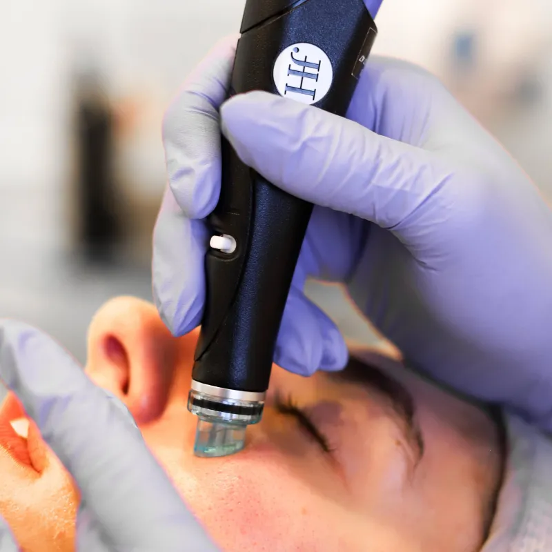 FACIAL - HydraFacial w/ Premium Boost