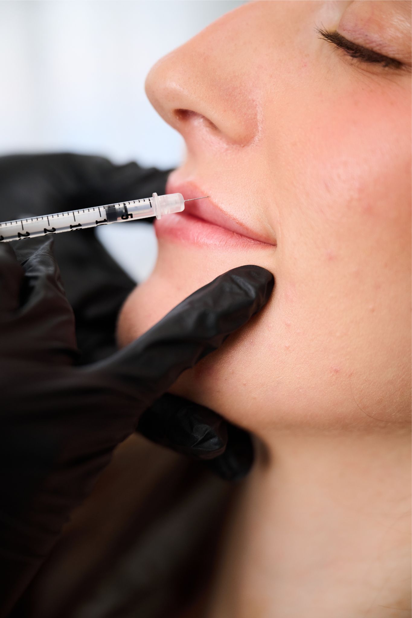 INJ- Lip Filler