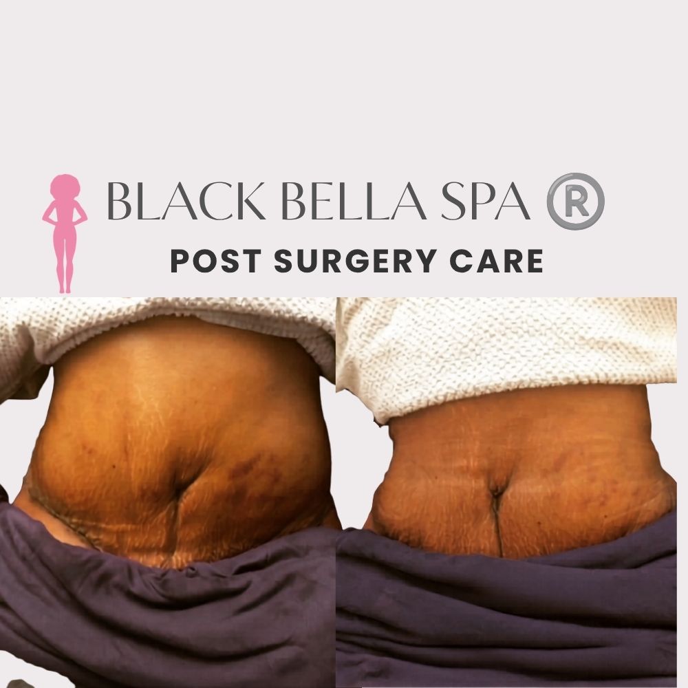 Package Post Surgery Care 10pk