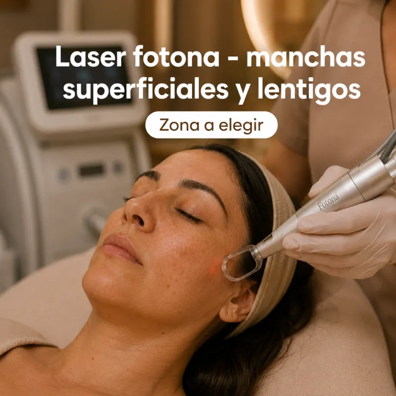 Láser Fotona · Manchas y Lentigos