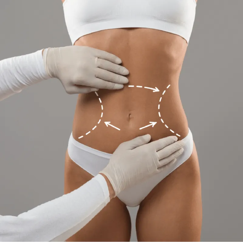Body Contouring treatment at Knightsbridge Advanced Beauty clinic