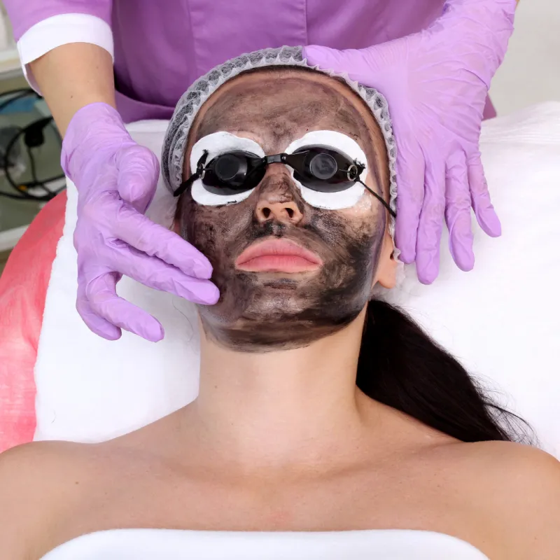 Carbon Laser Peel treatment at Knightsbridge Advanced Beauty
