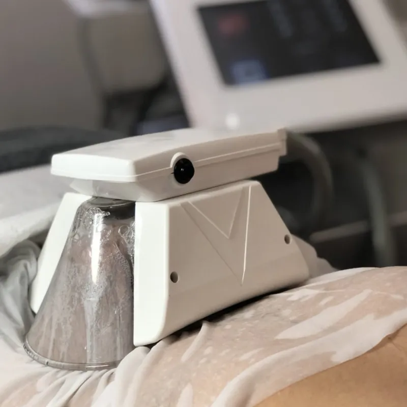 Professional Cryolipolysis Machine for fat freezing in Knightsbridge