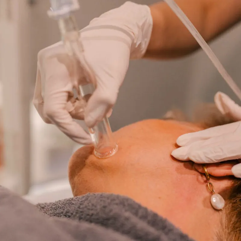 HydraFacial treatment at Knightsbridge Advanced Beauty clinic