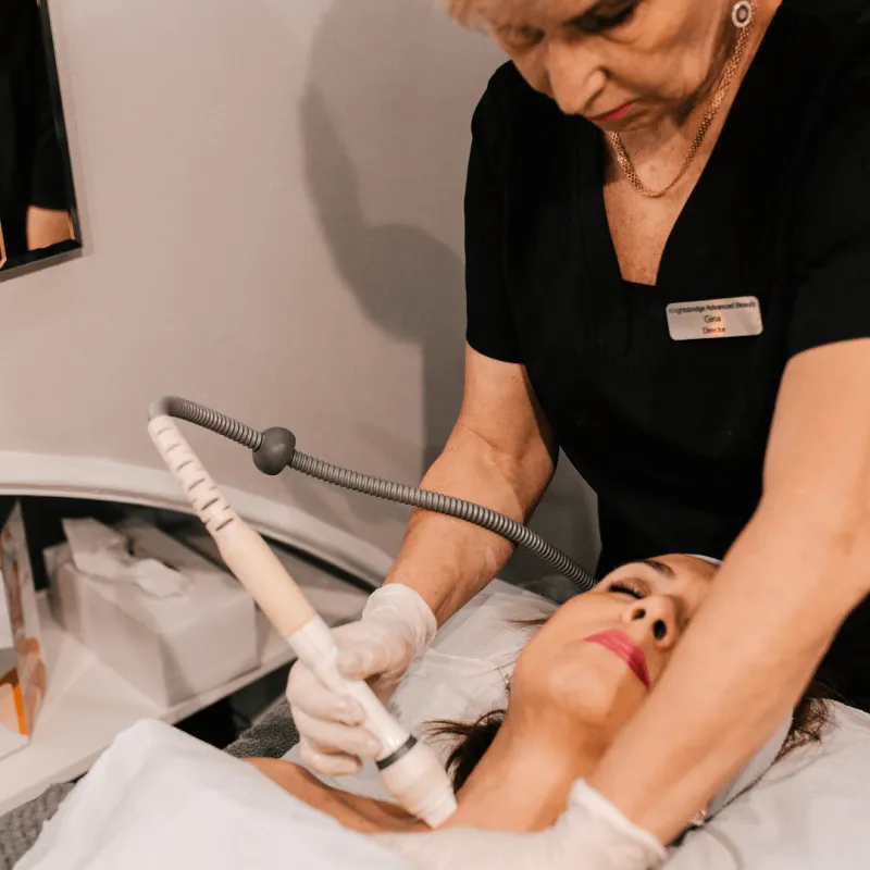 RF Microneedling treatment at Knightsbridge Advanced Beauty clinic