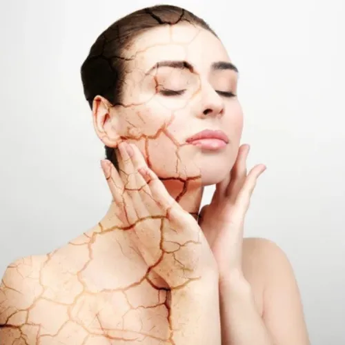 DRY / DAMAGED SKIN