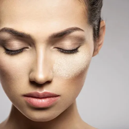 SENSITIVE SKIN