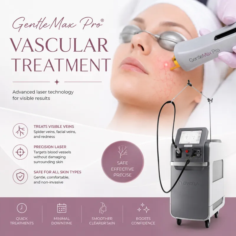 3 Sessions - Spider Veins Removal
