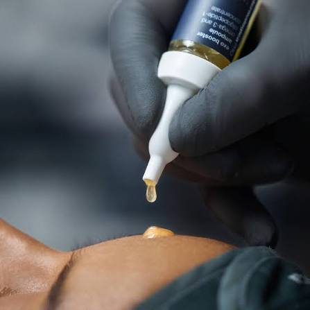 Exosomes Boost Add-On