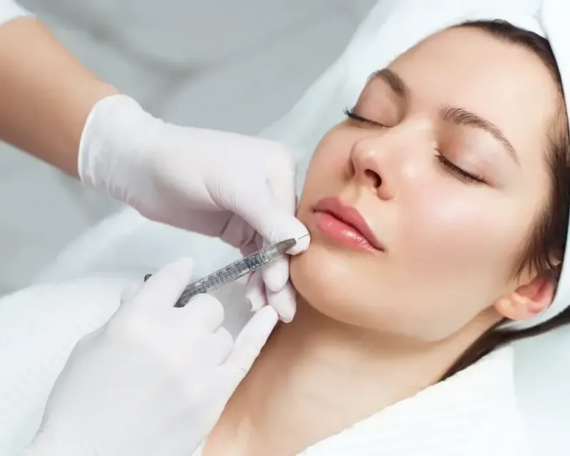 1 Vial of Filler