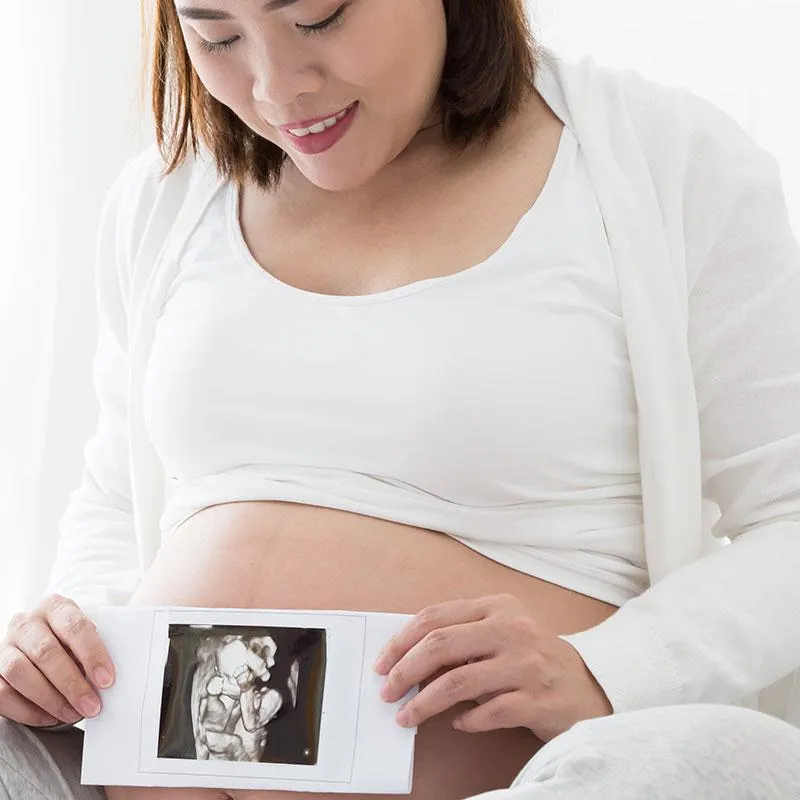 Sponsor 3D/4D Plus Gender (Non-Diagnostic Ultrasounds)