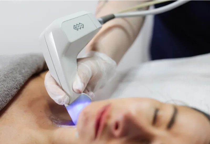 ecommerce.upsell.product_image_alt