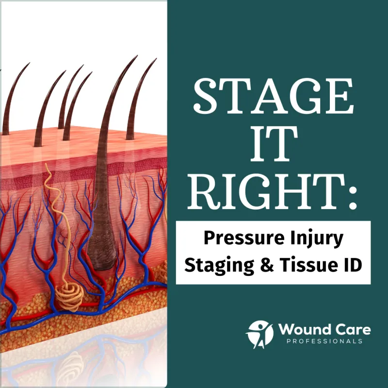 ecommerce.upsell.product_image_alt