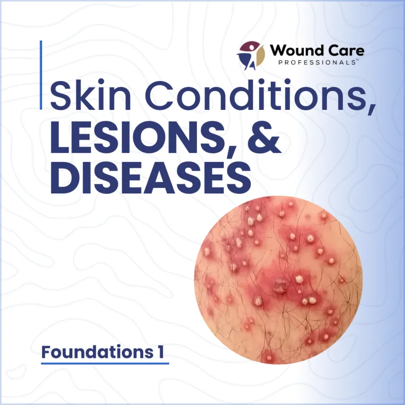 ecommerce.upsell.product_image_alt