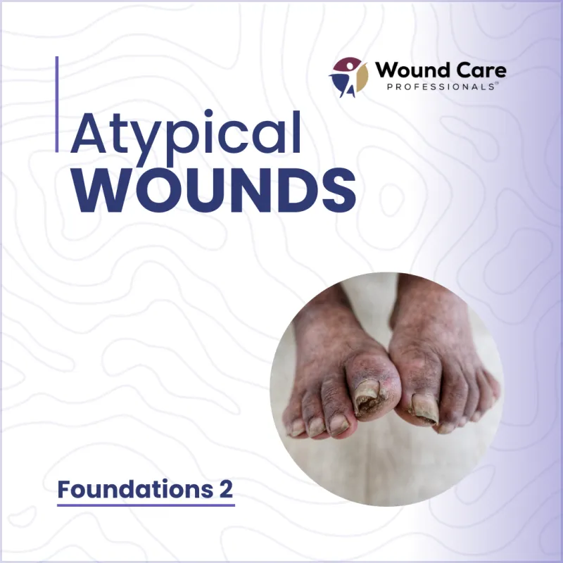 ecommerce.upsell.product_image_alt