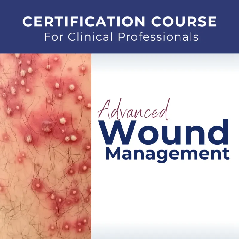 ecommerce.upsell.product_image_alt