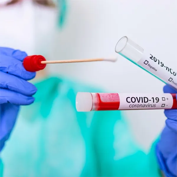 [A00129276] - SCREEN TEST COVID-FLU A/B Test rapido immunocromatografico individuazione qualitativa antigeni virus SARS-CoV-2 + Influenza A e B presenti in campioni da tampone rinofaringeo Screen Italia