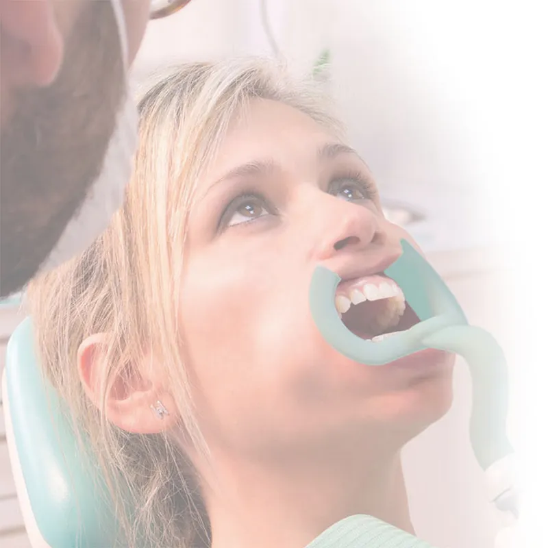 [A00110560] - OBF ORAL BIOFILTER Separatore labiale predisposta per aspirazione [06 pz] Protechno