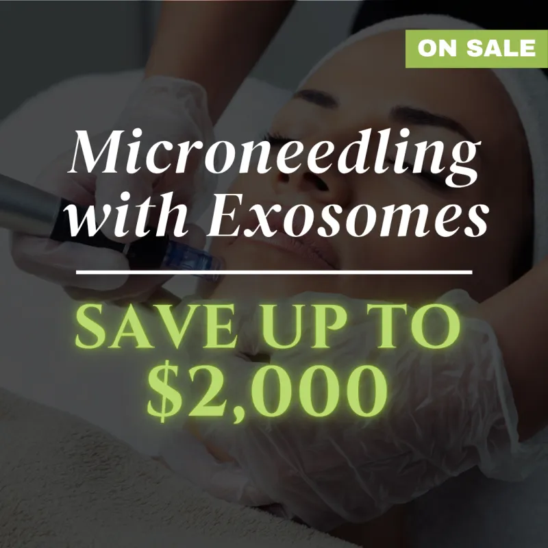 ecommerce.upsell.product_image_alt