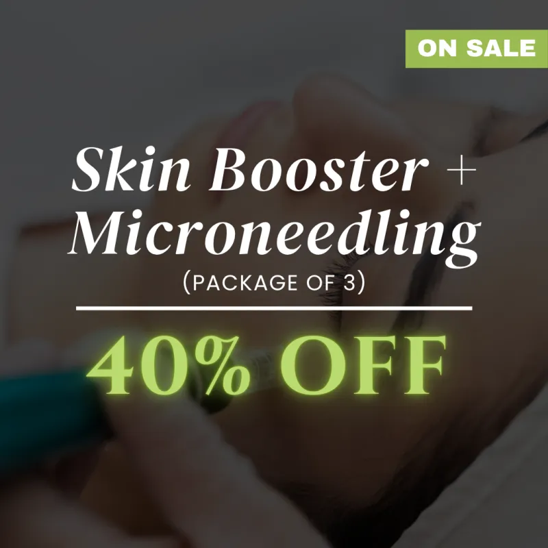 ecommerce.upsell.product_image_alt