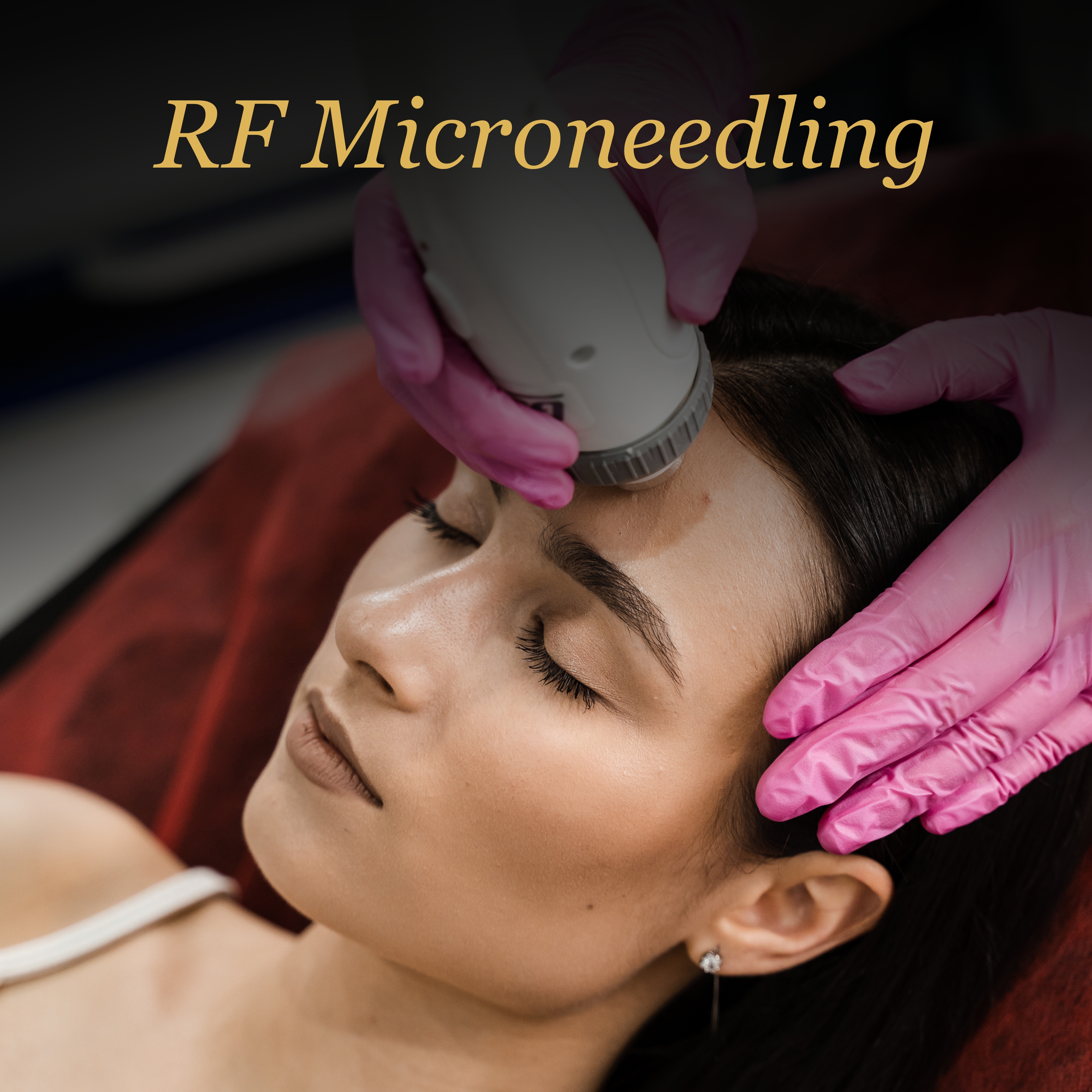 ecommerce.upsell.product_image_alt