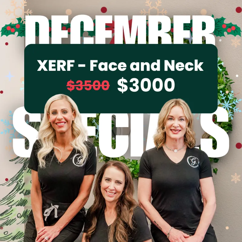 ecommerce.upsell.product_image_alt