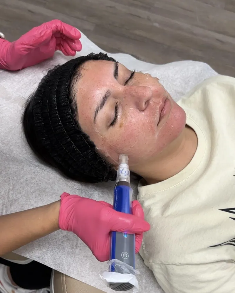 ecommerce.upsell.product_image_alt