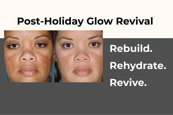 Post-Holiday Glow Revival: Rebuild. Rehydrate. Revive.