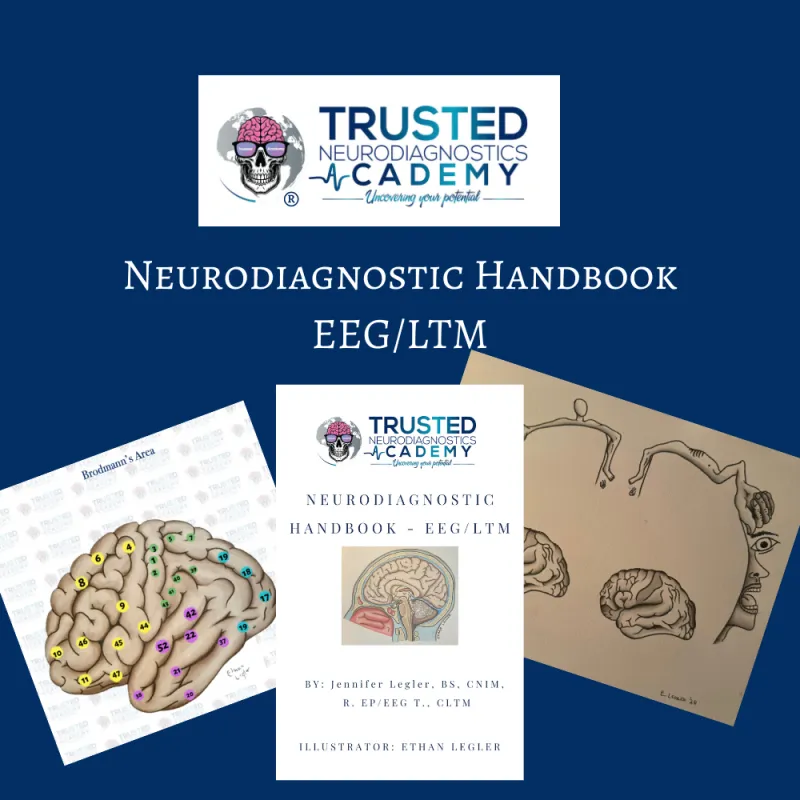 ecommerce.upsell.product_image_alt