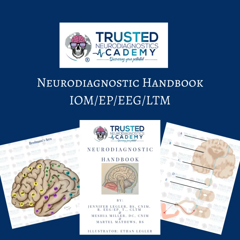 ecommerce.upsell.product_image_alt