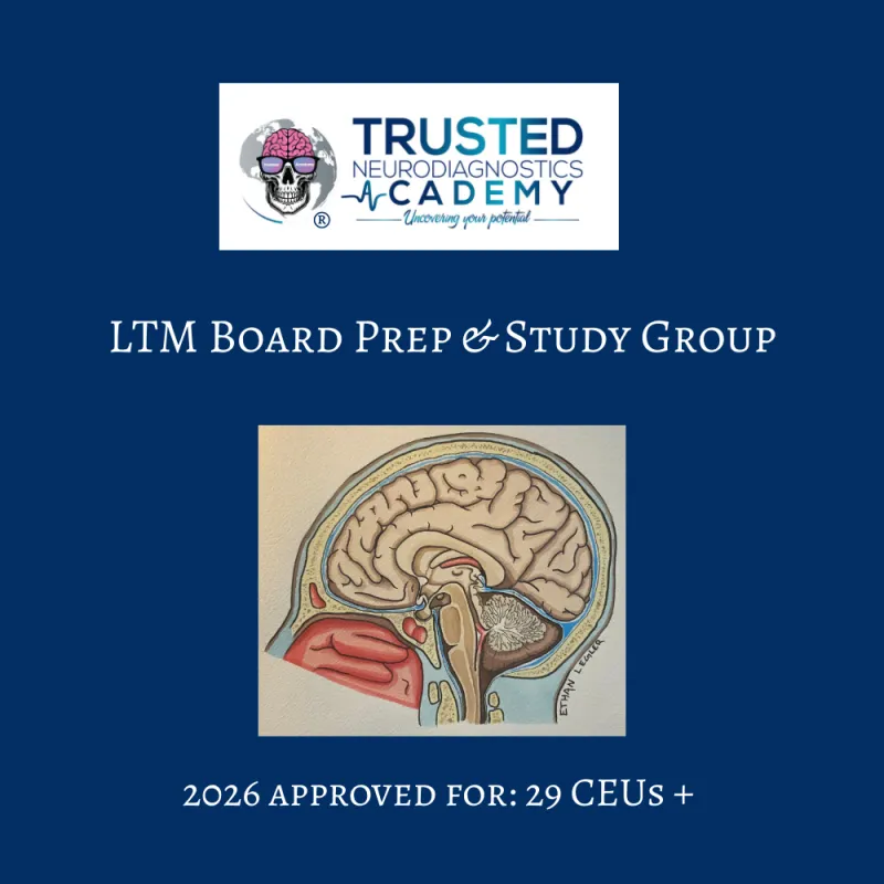 ecommerce.upsell.product_image_alt