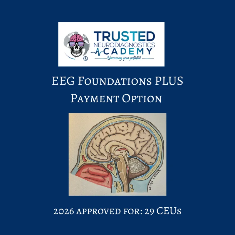 ecommerce.upsell.product_image_alt